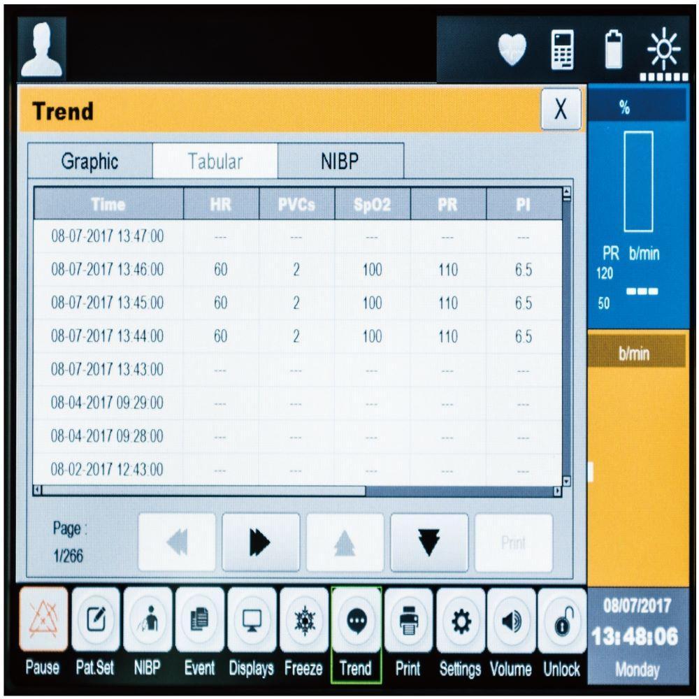 Patient Monitor System (BT-740)