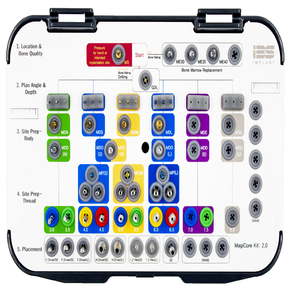 [IBS IMPLANT] MagiCore Kit