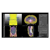 MEDICAL IP DeepCatch